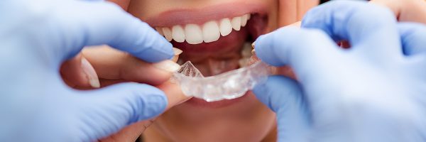 orthodontist-with-invisalign-patient (1)